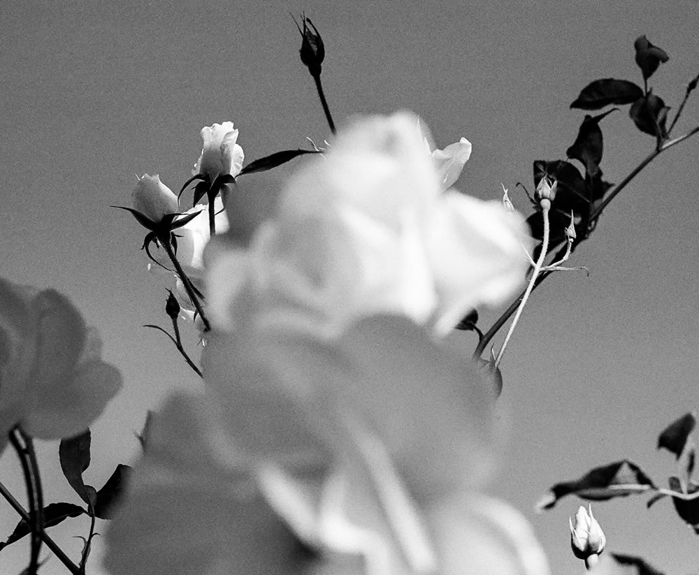 大阪心斎橋でボトックス注射、シミ取り、まぶた・たるみ整形手術なら美容外科フェレザクリニック